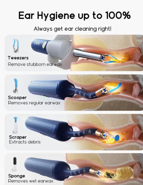 Smart Endoscope Earpick Kit