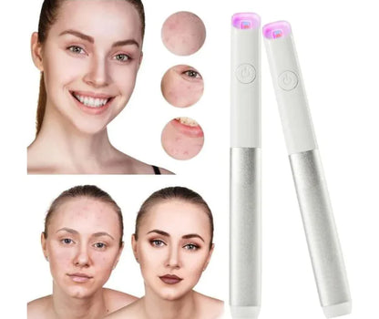 Red & Blue Light Facial Beauty Tool for Clear